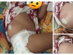Forum Kades Kecamatan Luwuk Timur Bantu Amira Penderita Tumor Belakang